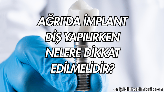 Ağrı'da İmplant Diş Yapılırken Nelere Dikkat Edilmelidir?