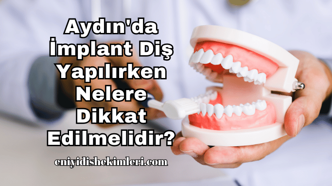 Aydın'da İmplant Diş Yapılırken Nelere Dikkat Edilmelidir?