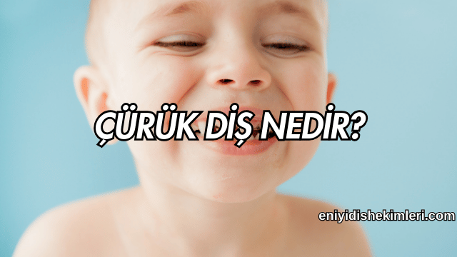 Çürük diş nedir?