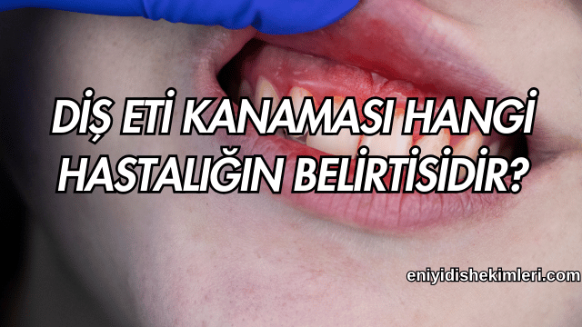 Diş Eti Kanaması Hangi Hastalığın Belirtisidir? Kopyası