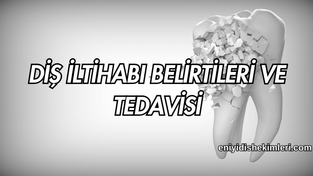 Diş İltihabı Belirtileri ve Tedavisi