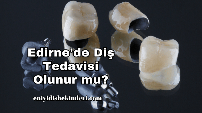 Edirne'de Diş Tedavisi Olunur mu?