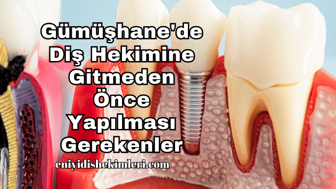 Gümüşhane'de Diş Hekimine Gitmeden Önce Yapılması Gerekenler