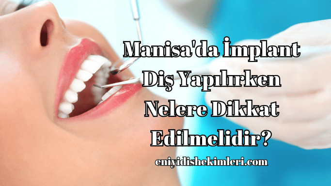 Manisa'da İmplant Diş Yapılırken Nelere Dikkat Edilmelidir?