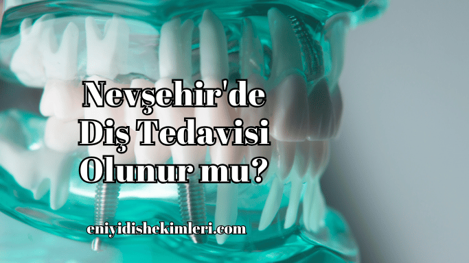 Nevşehir'de Diş Tedavisi Olunur mu?