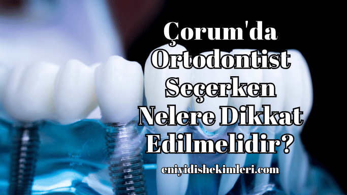 Çorum'da Ortodontist Seçerken Nelere Dikkat Edilmelidir?