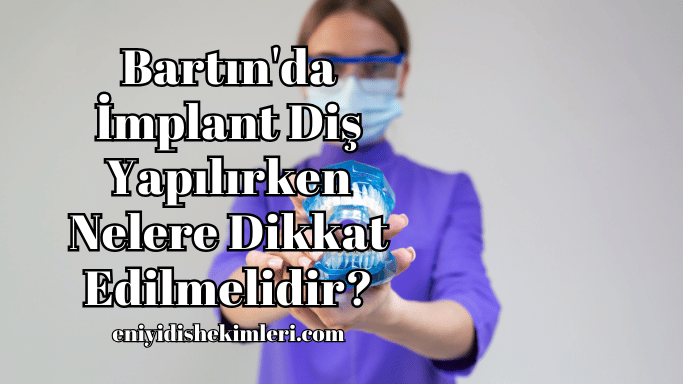 Bartın'da İmplant Diş Yapılırken Nelere Dikkat Edilmelidir?