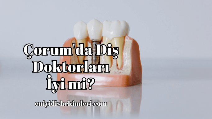 Çorum'da Diş Doktorları İyi mi?