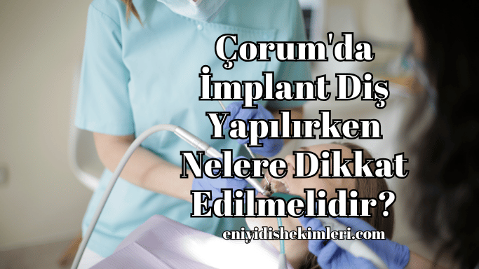 Çorum'da İmplant Diş Yapılırken Nelere Dikkat Edilmelidir?