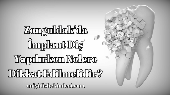 Zonguldak'da İmplant Diş Yapılırken Nelere Dikkat Edilmelidir?