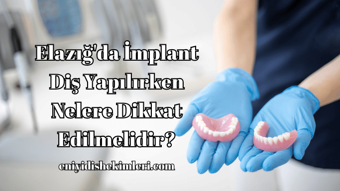 Elazığ'da İmplant Diş Yapılırken Nelere Dikkat Edilmelidir?