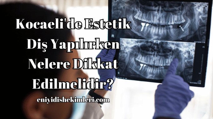 Kocaeli'de Estetik Diş Yapılırken Nelere Dikkat Edilmelidir?