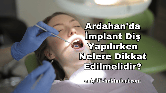 Ardahan'da İmplant Diş Yapılırken Nelere Dikkat Edilmelidir?