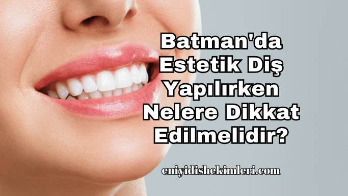 Batman'da Estetik Diş Yapılırken Nelere Dikkat Edilmelidir?