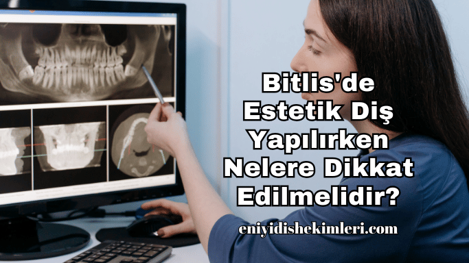 Bitlis'de Estetik Diş Yapılırken Nelere Dikkat Edilmelidir?