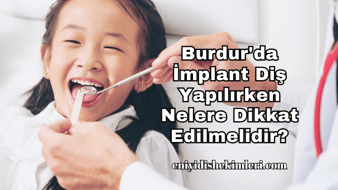 Burdur'da İmplant Diş Yapılırken Nelere Dikkat Edilmelidir?