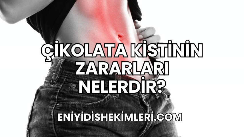 Çikolata Kistinin Zararları Nelerdir?