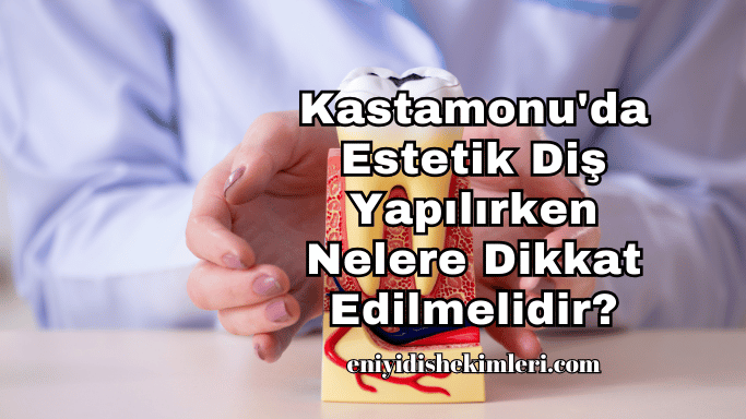 Kastamonu'da Estetik Diş Yapılırken Nelere Dikkat Edilmelidir?