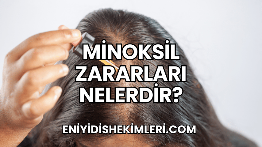 Minoksil Zararları Nelerdir?