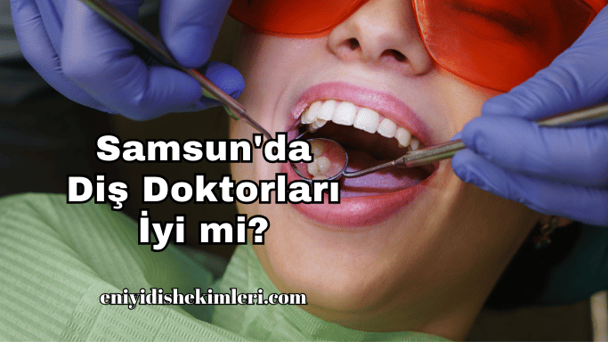 Samsun'da Diş Doktorları İyi mi?