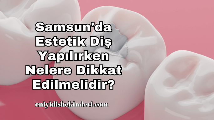 Samsun'da Estetik Diş Yapılırken Nelere Dikkat Edilmelidir?