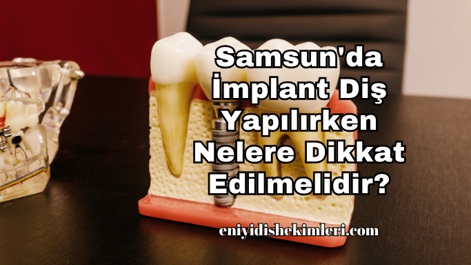 Samsun'da İmplant Diş Yapılırken Nelere Dikkat Edilmelidir?