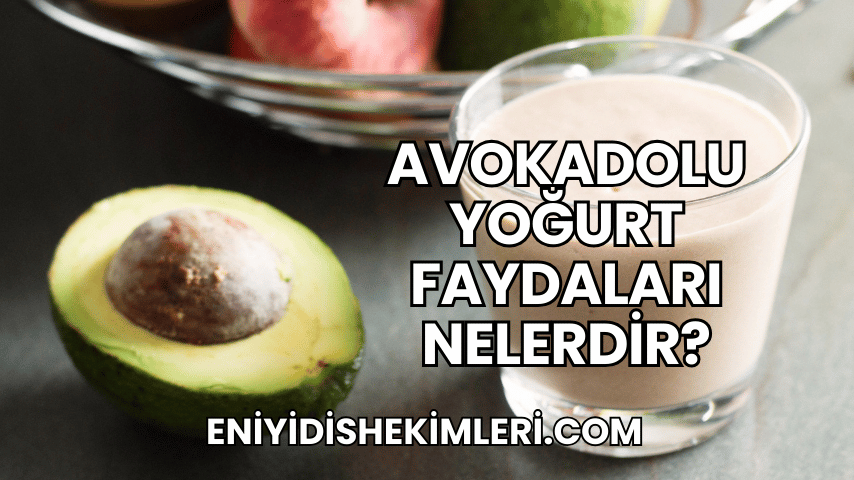 Avokadolu Yoğurt Faydaları Nelerdir?