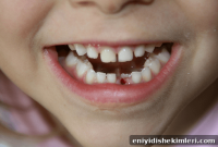 Are Red Spots on My Baby’s Gums Normal? What They Mean and When to Act
