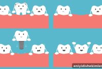 Dental Implant Costs: Prices by Type, Procedure & Ways to Save