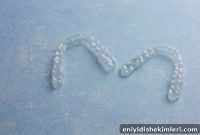 What to Know Before Getting Invisalign: Essential Patient Guide