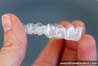 10 Surprising Benefits of Invisalign Beyond Appearance