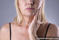Does Wisdom Tooth Extraction Cause Your Face to Look Thinner?