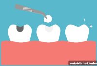 When You Need a Dental Filling: What to Expect at Your Visit