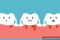 Gum Disease Stages, Prevention Tips, and Treatment Options