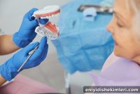 Dental Implant Procedure: What to Expect Step by Step