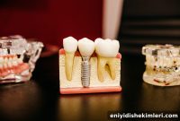 Why Choose Dental Implants for Tooth Replacement