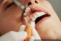 Dental Implant Recovery: Complete Guide to Smooth Healing