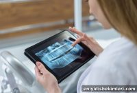 5 Reasons Dental Implants Are So Popular Today