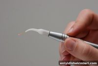 Low-Level Laser Therapy Matches Formocresol for Saving Primary Molars