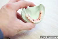 Dental Implants vs Dentures: Which Option Suits Your Smile?