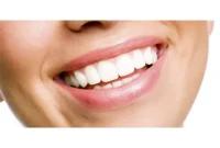 Safest Teeth Whitening Methods: What Dentists Recommend