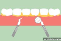 Does a Dental Cleaning Hurt? What to Expect at Your Visit