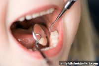 Prevent Teeth Yellowing: Top Tips to Maintain a Bright Smile