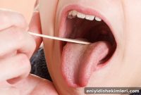 Rising Cause of Oral Cancer: What You Need to Know