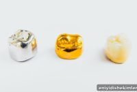 Dental Crowns Explained: Pain, Safety, Cost and 11 Common FAQs