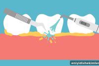 Dread Dental Cleanings? 8 Ways to Reduce Pain and Anxiety