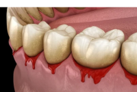 Don’t Ignore This Key Factor When Treating Gum Disease