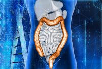 Colorectal Cancer Rise Linked to Your Oral Microbiome