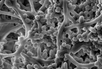 Why Biofilms Matter: What Breakfast Skippers Need to Know