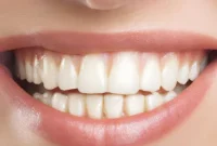 Whitening Teeth with Hydroxyapatite: What You Need to Know